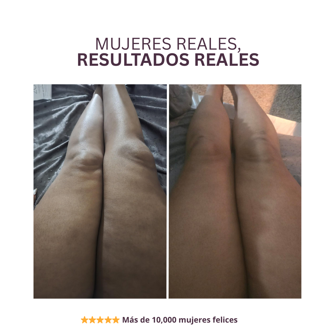 Firmessa™ Reafirma & Esculpe Tus Piernas