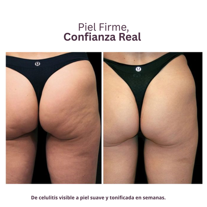 Firmessa™ Reafirma & Esculpe Tus Piernas