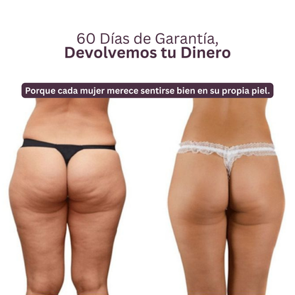Firmessa™ Reafirma & Esculpe Tus Piernas